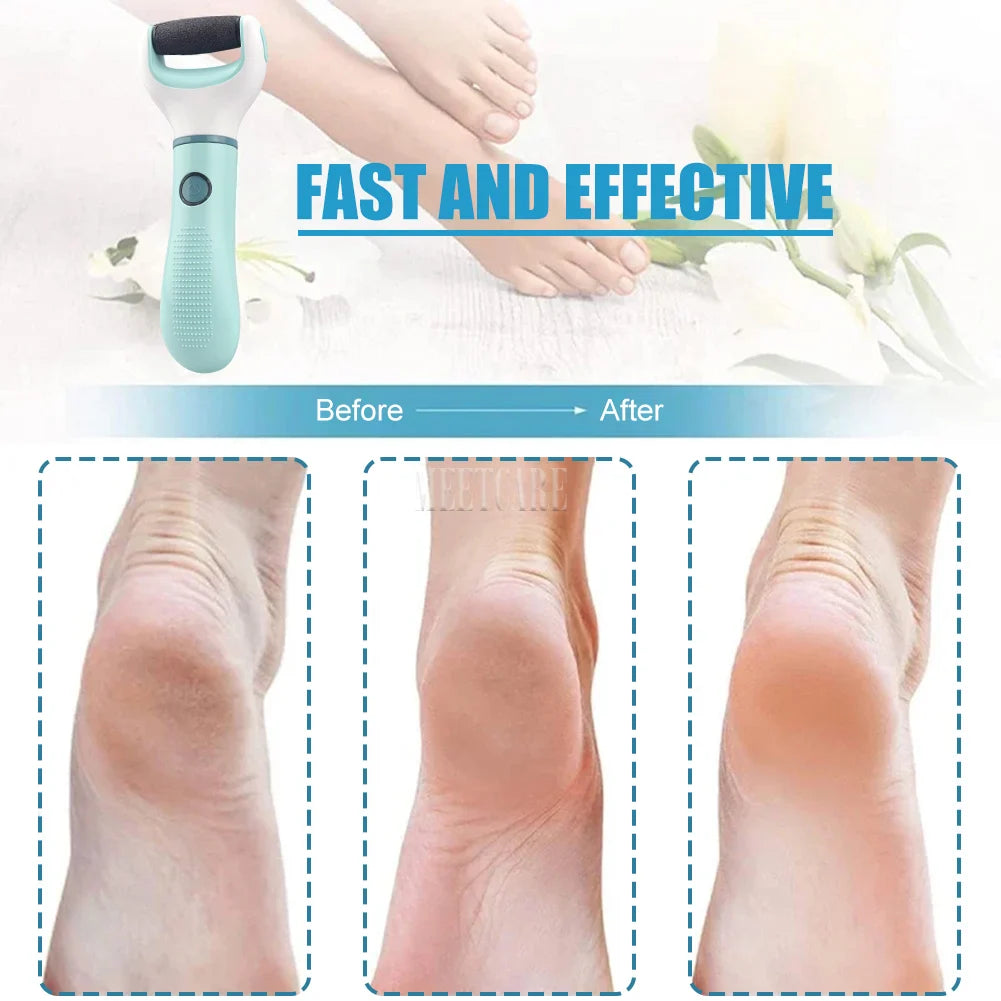 Wireless Electric Foot Grinder – Callus Remover & Pedicure Tool